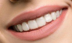 Teeth Whitening Teeth Whitening
