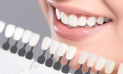 Veeners Teeth Veeners Teeth